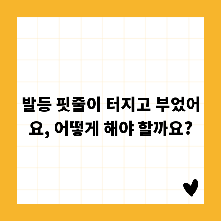 발등 핏줄이 터지고 부었어요, 어떻게 해야 할까요?
